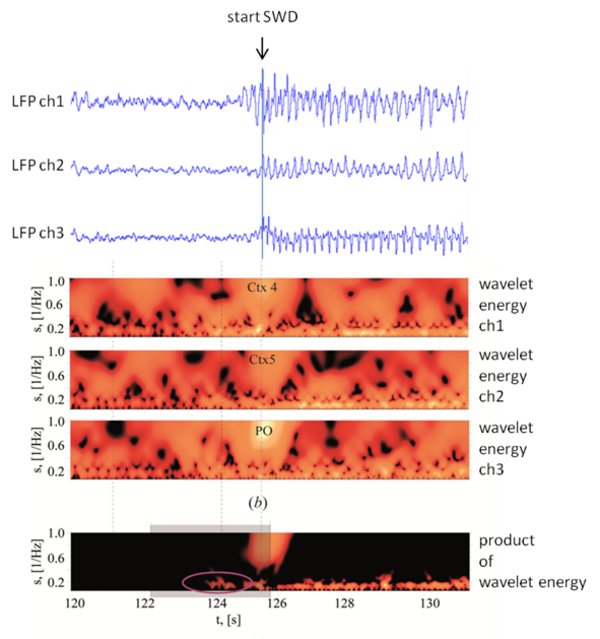 seizure-prediction-and-prevention